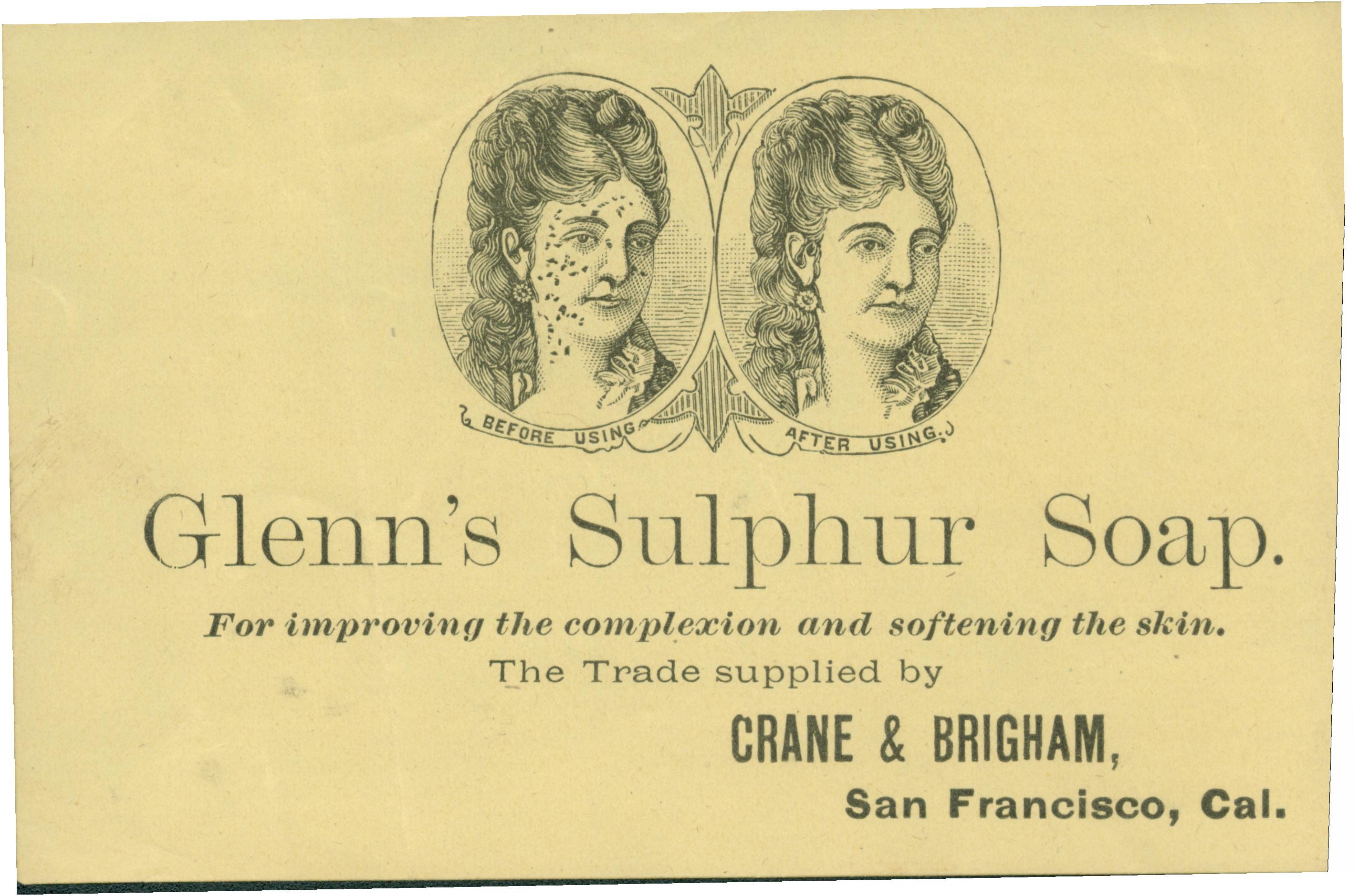This trade card shows a before and after engraving of a woman who used sulphur soap to clear her complexion. Details about the product are listed below the image.